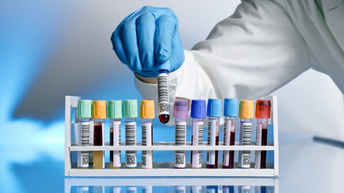 Image of a laboratorian placing a test tube in a holder