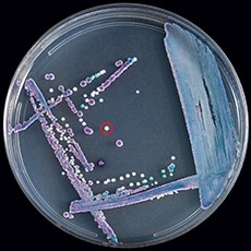 Petri dish with mixed culture ofCandida glabrata (purple), Candida tropicalis (navy blue), and Candida auris (white, circled in red) on CHROMagar Candida.