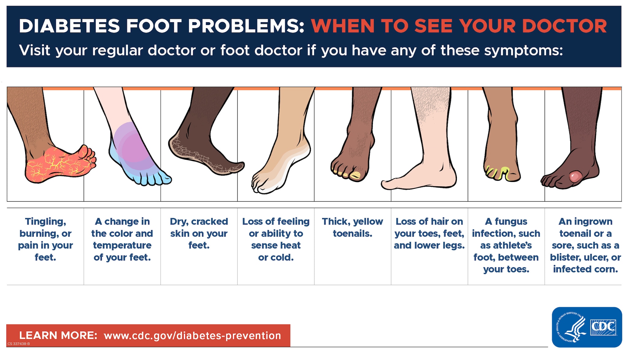 Visit your regular doctor or foot doctor if you have any of these symptoms.