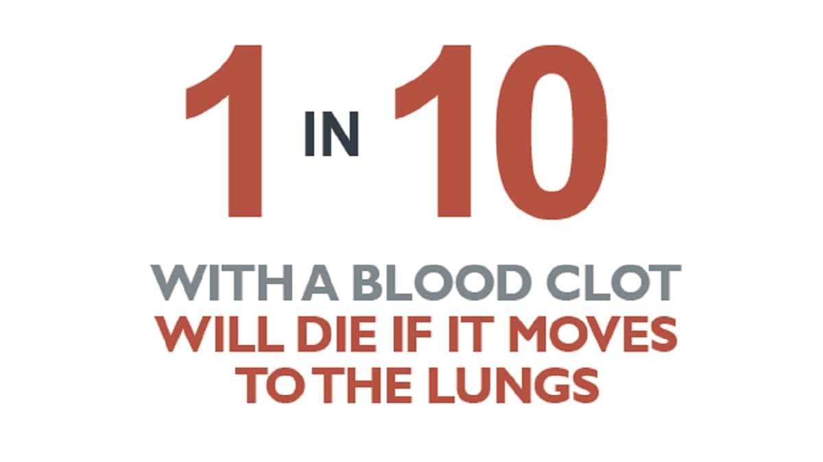 1 in 10 with a blood clot will die if it moves to the lungs