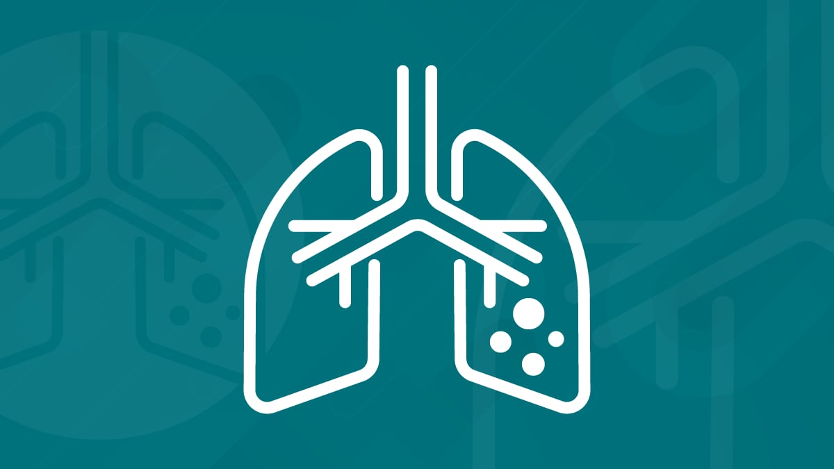 Division of Tuberculosis Elimination