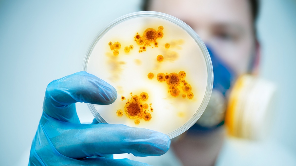 Scientist holding petri dish with growing culture.