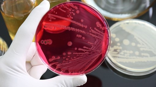 Salmonella growing on a petri dish being held by a gloved hand in a lab.