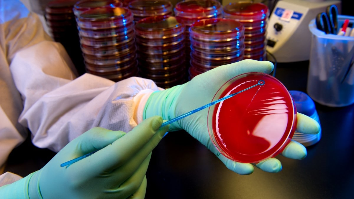 A laboratory worker cultures streptococci.