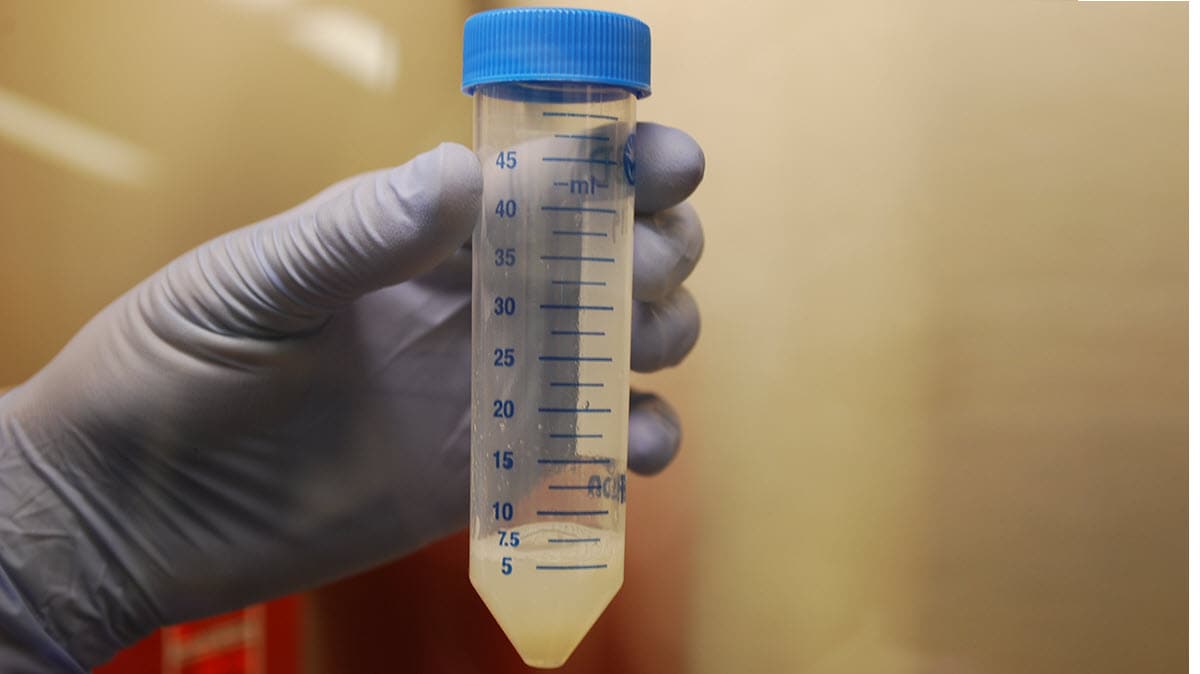 A clinician holds a conical tube with a specimen