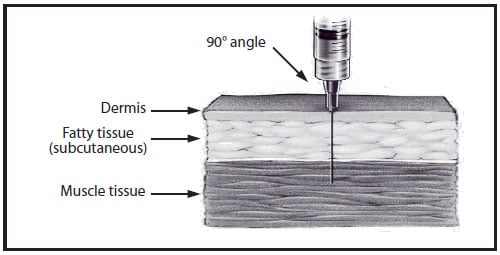 This drawing shows intramuscular needle insertion into a cross-section of skin. The needle is inserted at a 90-degree angle and penetrates the dermis, fatty tissue (subcutaneous), and muscle tissue.